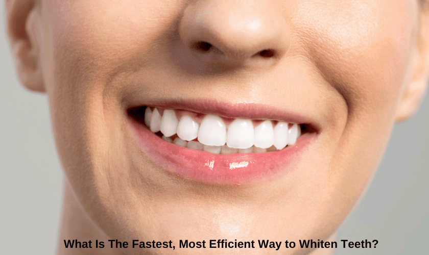 What Is The Fastest, Most Efficient Way to Whiten Teeth. W H